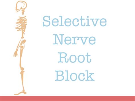 Image result for Selective Nerve Root Block