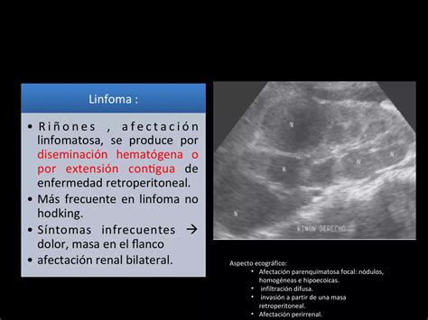 Bazo Y Riñon Ecografia