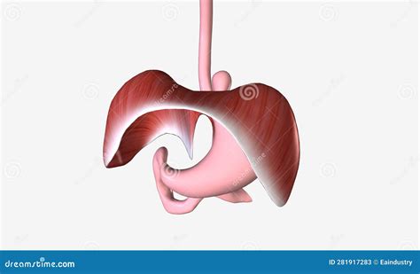 A Hiatal Hernia is a Condition in Which the Upper Part of the Stomach Bulges through an Opening ...