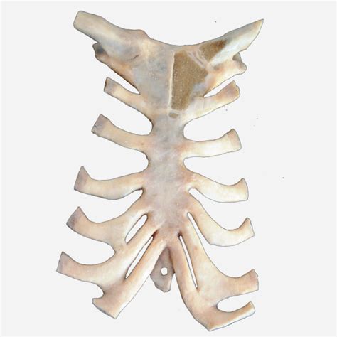 P3007 – Sternoclavicular and Sternocostal Joints | Prosections