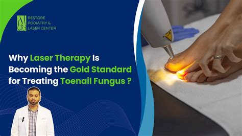 How Much Is Laser Treatment for Nail Fungus Nassau County?