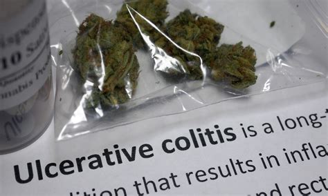 Multimatrix Mesalamine effective in treatment of paediatric Ulcerative ...