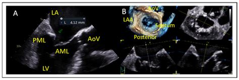 Journal of Clinical Medicine | An Open Access Journal from MDPI