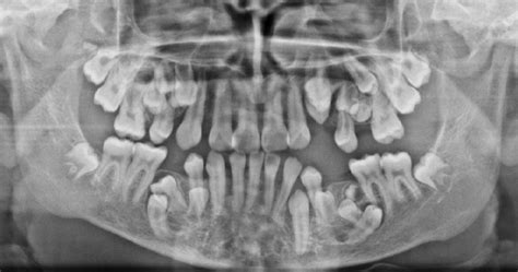 Image result for Alien in Spce