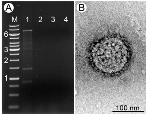 The First Non-LRV RNA Virus in Leishmania