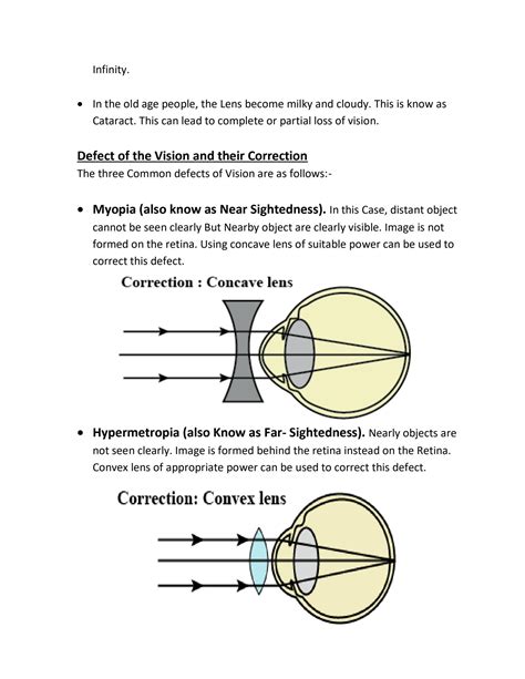 Image result for Science Class 10 Human Eye Notes