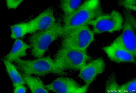 RPS3 antibody (66046-1-Ig) | Proteintech