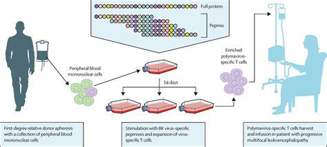 What Is Bk Virus Pcr at Mary Langan blog