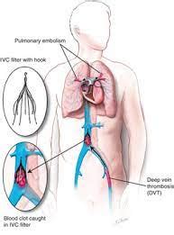 Specialization | Dr. Shiv Goel Cardiologist