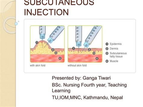 Image result for Subcutaneous Injection Procedure