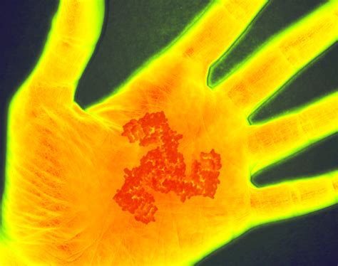 Study identifies gene that makes gentle touch feel painful after injury ...
