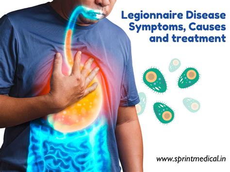 Legionnaire Disease: Symptoms, Causes and treatment | Sprint Medical