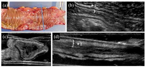 Consistency of Trans-Abdominal and Water-Immersion Ultrasound Images of ...