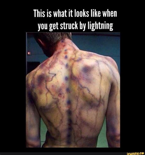 Can You Get Struck By Lightning In A Hammock at Muriel Simmons blog