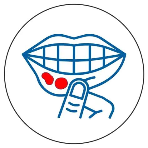 Orasore Mouth Ulcer Tablet | Effective Relief for Mouth Ulcers – Health ...