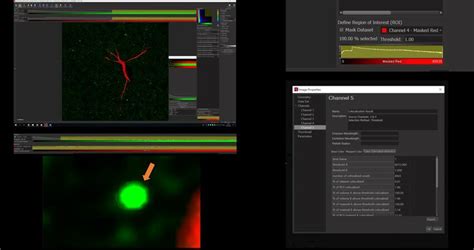 Image result for ImageJ Colocalization Coloc