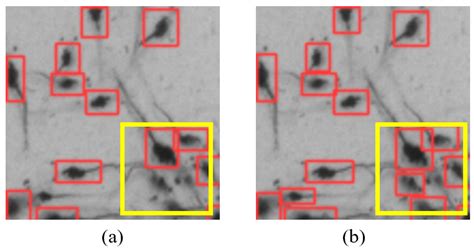 Shrimp Larvae Counting Based on Improved YOLOv5 Model with Regional ...