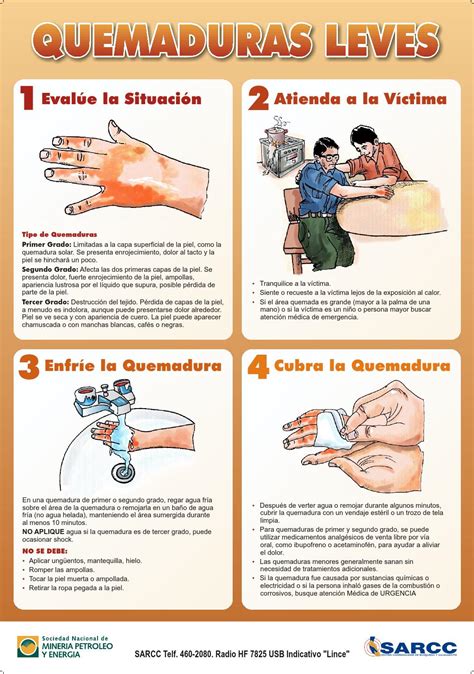 Quemaduras Primer Grado