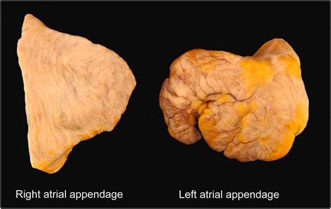 Anatomic considerations and examination of cardiovascular specimens (excluding devices ...