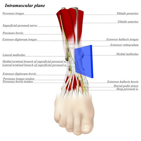 Image result for Ankle Anterolateral Approach Injection