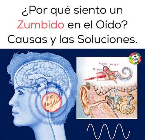 ZUMBIDO EN EL OÍDO: CAUSAS COMUNES Y SOLUCIÓN EFECTIVA