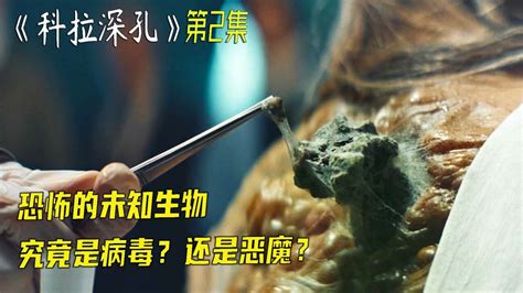 近半感染者90天内死亡！“超级真菌”来袭，该怎么预防？-桂林生活网新闻中心