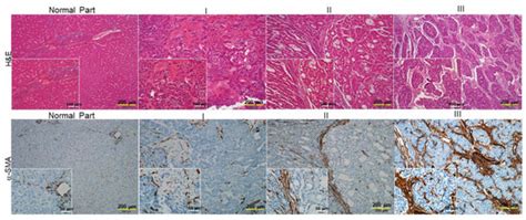 Hepatic Stellate Cell Modulates the Immune Microenvironment in the ...
