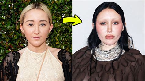 Plastic Surgery Disasters 的图像结果