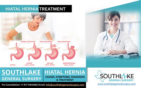 Can’t-Miss Takeaways Of Tips About How To Fix Hiatal Hernia - Horsebud99
