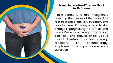 Understanding Penile cancer | Robotic Surgeon | PDF