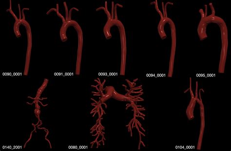 MeshGraphNet for Reduced-Order cardiovascular simulations — NVIDIA ...