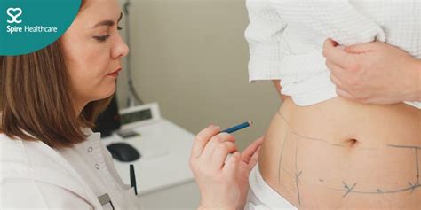 Ask the Consultant: Cosmetic Body Surgery. FREE in-person event ...