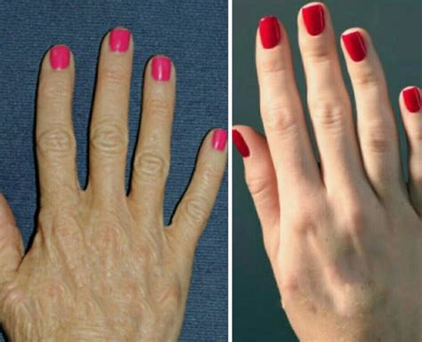 हाथों को जवां दिखाने वाले ट्रिक्‍स| Tricks to Get Younger Looking Hand ...