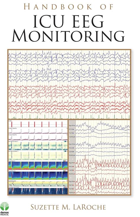 Buy Handbook of ICU EEG Monitoring Book Online at Low Prices in India ...