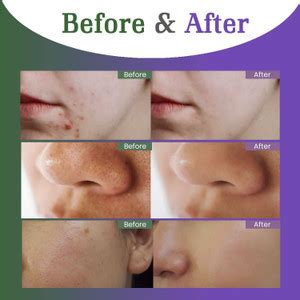 Emijun mud face pace Green Tea Mask Stick For Face Blackheads ...