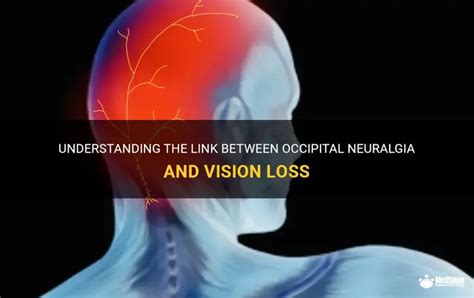 Understanding The Link Between Occipital Neuralgia And Vision Loss ...