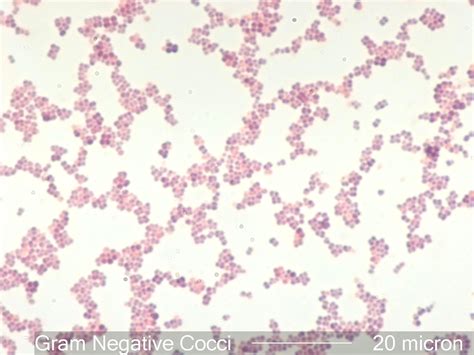 Gram Negative Cocci