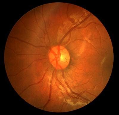 CHASE DB1 - Dataset Ninja