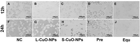 CuO-NPs Induce Apoptosis and Functional Impairment in BV2 Cells Through ...