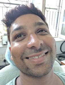 Routine Dental Checkup. Dental Basics. Kolkata.