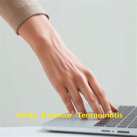 Rest & Rehab for Wrist Extensor Tendonitis: Key Insights