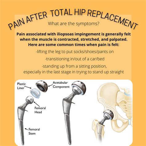 What To Do After Total Hip Replacement at Darrel Ferreira blog