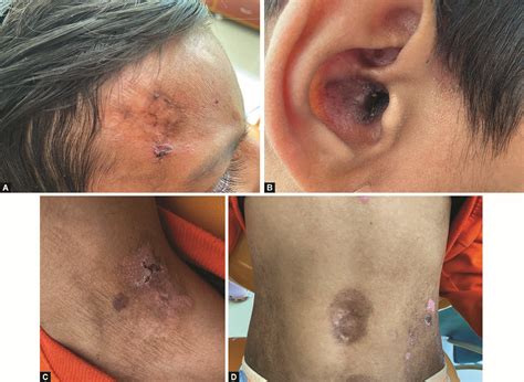 Oral Health Considerations for the Management of Patients with ...