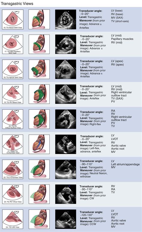 Transesophageal Echocardiography Tomographic Views - Clinical Tree