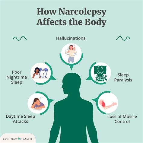 What Is Narcolepsy? Symptoms, Causes, Diagnosis, Treatment, and Prevention