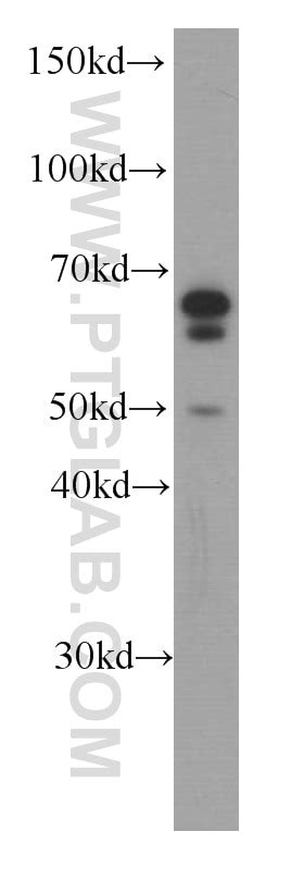 MLPH antibody (66092-1-PBS) | Proteintech