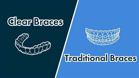 Understanding The Different Types Of Braces Adjustments