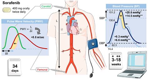 Pazopanib, Cabozantinib, and Vandetanib in the Treatment of Progressive ...