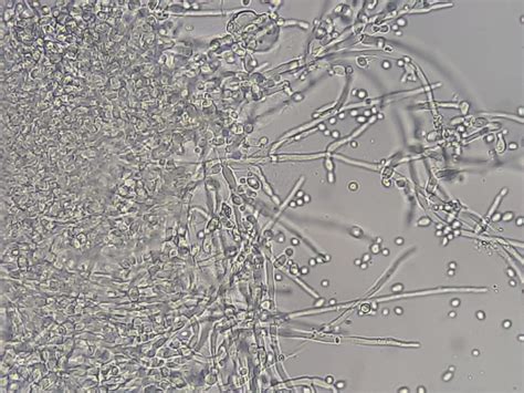Candida albicans- Introduction, Morphology, Pathogenicity, Lab