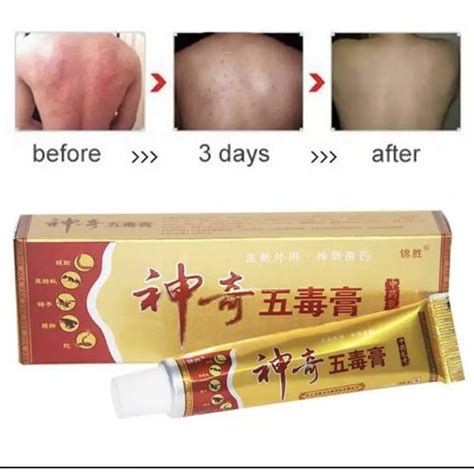 Jual Salep gatal cina paling berkhasiat - Kota Surabaya - toko obat ...